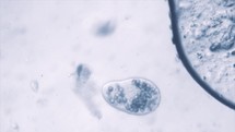 Disease Sickness Disease Death Fleas Black Plague Death Microscopic Germs Infection Research Science Pandemic Epidemic Fear