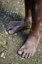 A child without shoes has dirty little feet