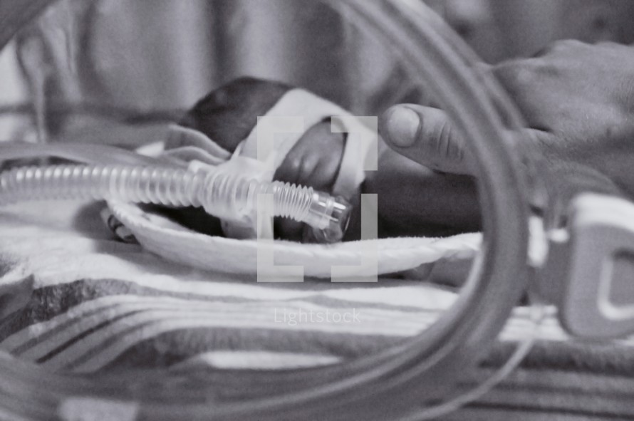 Premature infant on breathing machine
