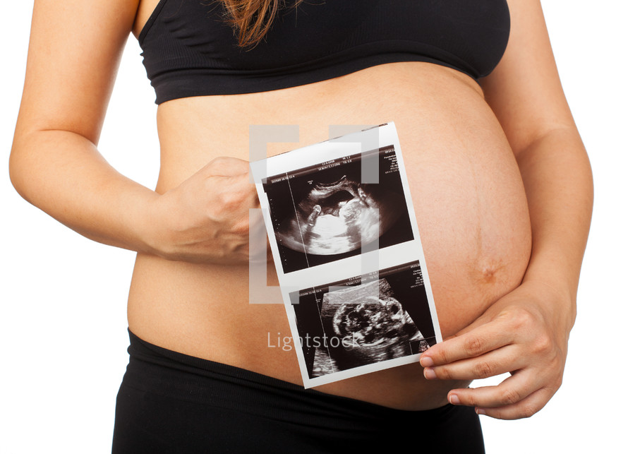 pregnant woman holding ultrasound pictures 