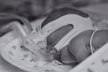 Premature baby on breathing machine