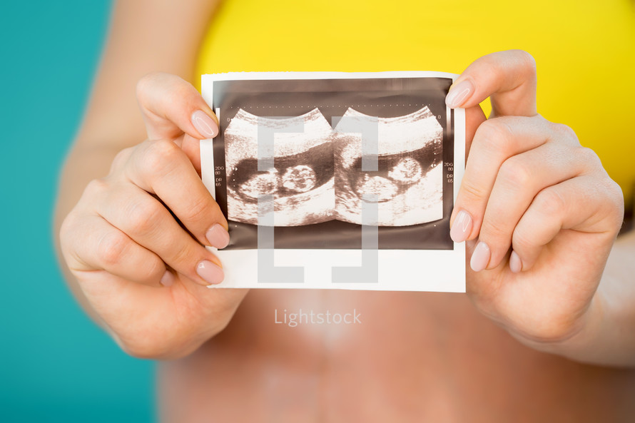 Close-up of unrecognizable pregnant woman holding ultrasound scan on her belly background. Maternity, motherhood, pregnancy, love, twins concept