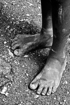 A child's dirty bare feet