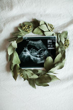wreath around an ultrasound picture 