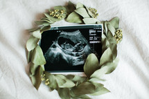 wreath around an ultrasound picture 