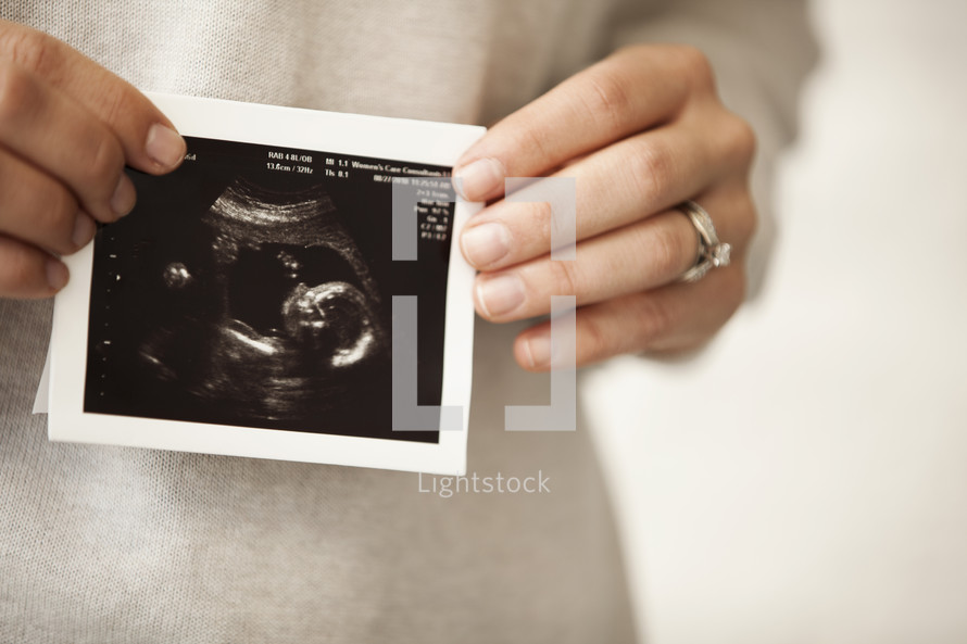 girl holding ultrasound