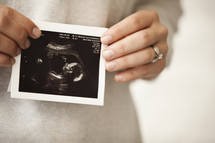 girl holding ultrasound
