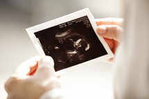 girl holding and looking at ultrasound