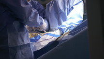 Surgeons performing a laproscopic lung surgery