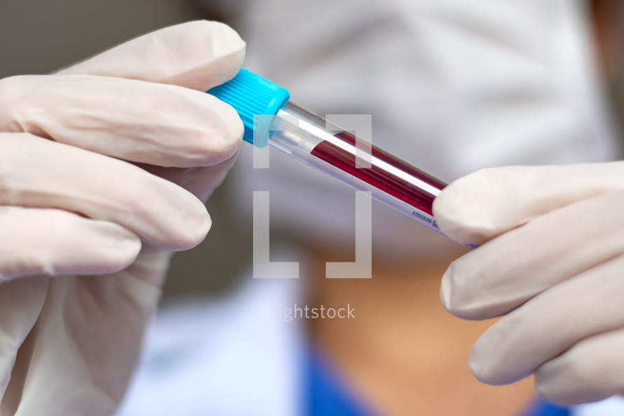 lab technician holding a test tube of blood 