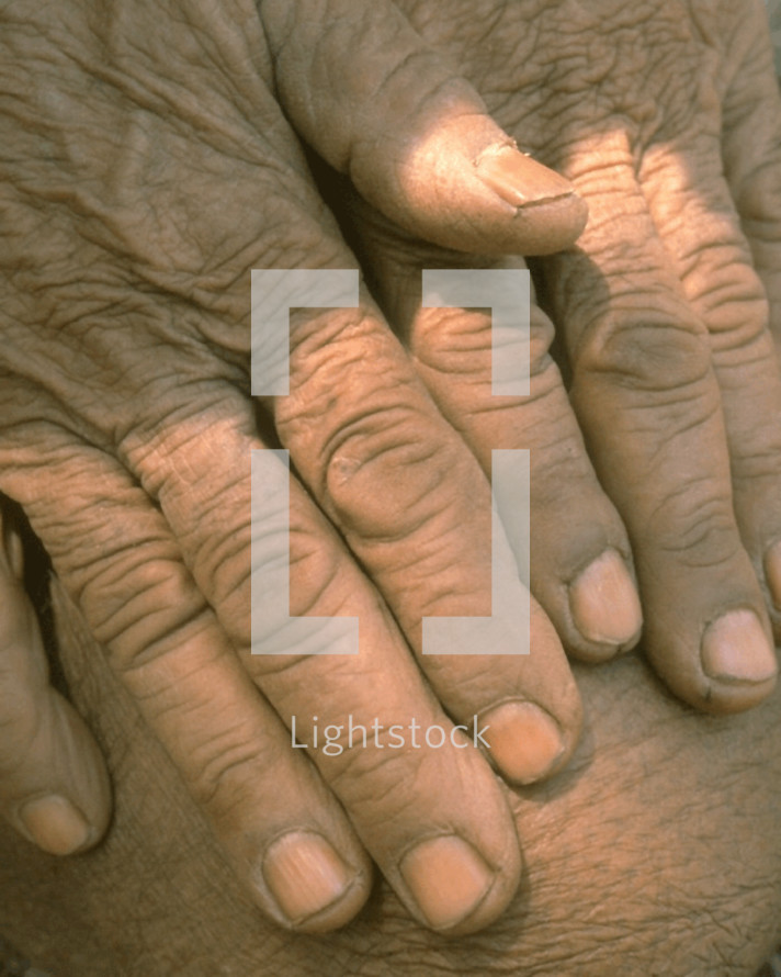 elderly hands 