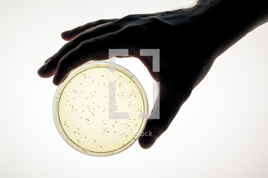 bacteria growth Petri dish 