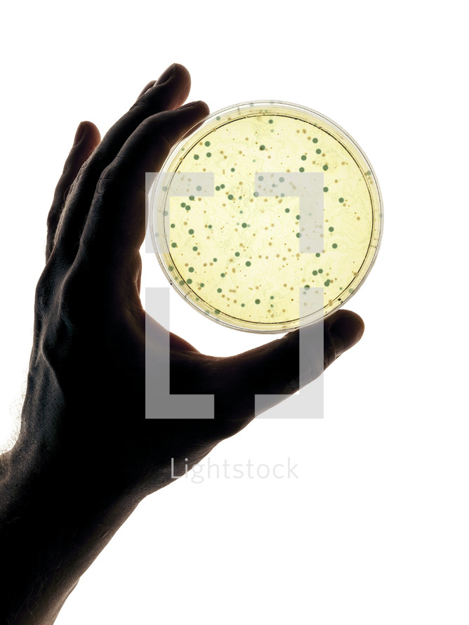 bacteria growth on a Petri dish