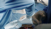 Close up on hands and instruments as Surgeons work during open heart surgery.