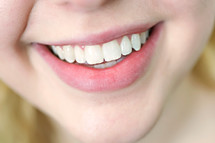 woman's teeth