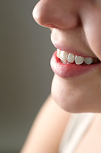 woman's teeth 