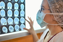 Young Female Doctor Examine Mri Picture