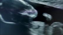 Baby scan monitor -  Tight shots of screen, macro lens