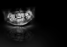 X-ray teeth jaw human cranium. Panoramic negative photo facial image of mouth young adult male. Medical design element sample blank template horizontal paper size A4. Panoramic radiograph is a scanning dental X-ray of the upper jaw maxilla and lower jawbone mandible. Black background with with glow, shadow and reflection. Medical horizontal design template for text