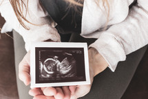 a mother holding an ultrasound 
