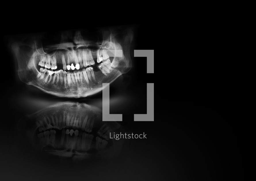 X-ray teeth jaw human cranium. Panoramic negative photo facial image of mouth young adult male. Medical design element sample blank template horizontal paper size A4. Panoramic radiograph is a scanning dental X-ray of the upper jaw maxilla and lower jawbone mandible. Black background with with glow, shadow and reflection. Medical horizontal design template for text
