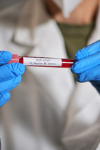 Coronavirus 2019-Ncov With Positive Blood Test