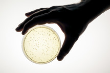 bacteria growth Petri dish 