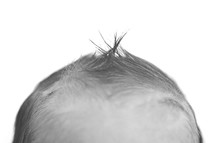 The top of a baby's head.