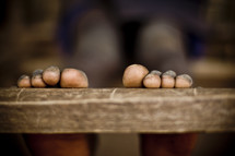 Weathered toes from a Sudanese child