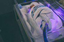 A baby receiving UV treatment for jaundice in a hospital.
