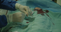Surgeons preforming a cardiac catheterization in an operating room in a hospital