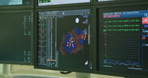 Monitors displaying medical data during a cardiac catheterization surgery