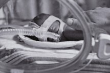 Premature infant on breathing machine