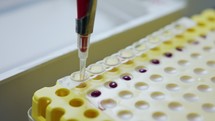 Close up shot of a pipette used in a lab to collect blood samples