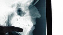 Dentist Hand points to Dental X-Ray