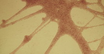 Heart cells pulsating as seen through a microscope
