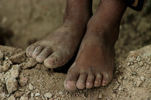 A child's feet - worn and dirty