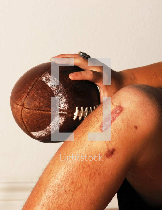 Football ACL Injury.