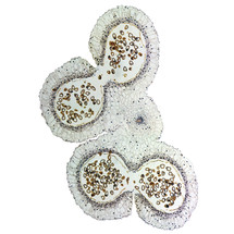 Light photomicrograph of Lily anther cross section seen through microscope