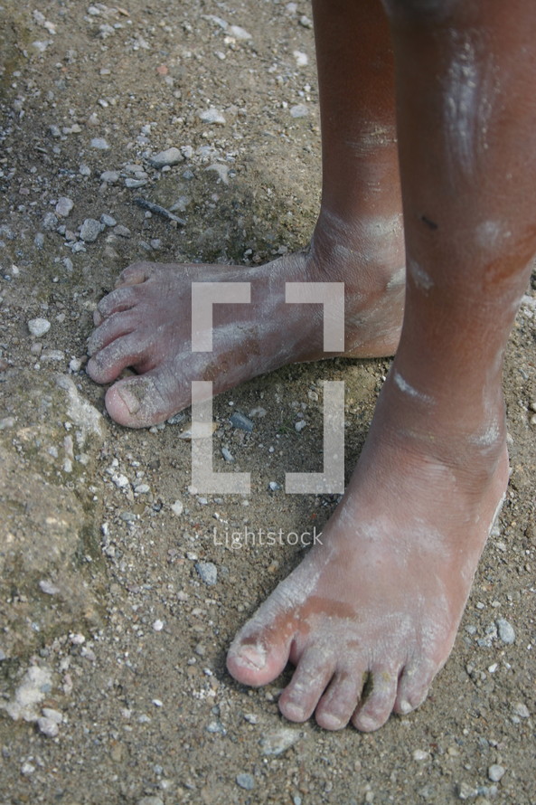 dirty bare feet 