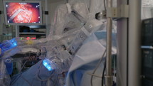 Minimally Invasive Robotic Surgery using advanced technology in a hospital.
