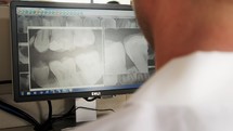 a dentist looking at digital scans 