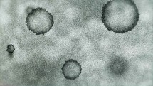 virus under a microscope 