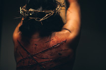 The suffering of Christ -- a beaten Jesus in His crown of thorns tied to the cross.