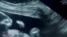Baby scan monitor -  Tight shots of screen, macro lens