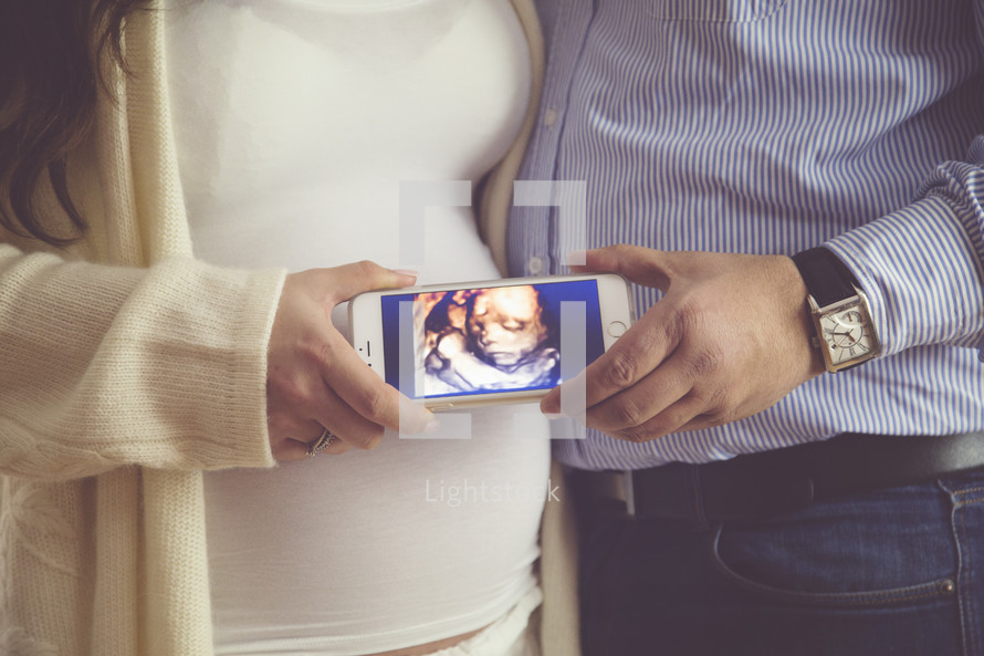 expecting couple with a picture of the ultrasound on a cellphone 