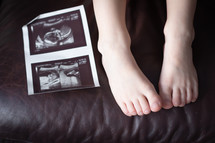 ultrasound and child's feet 