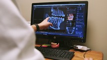 a dentist looking a digital x-rays