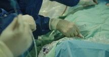 Surgeons preforming a cardiac catheterization in an operating room in a hospital