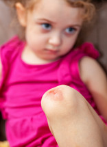 A child with an injured scraped knee